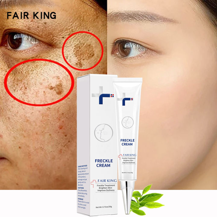 FAIR KING Effective Freckle Cream Remove Dark Spots Witening Cream Fade