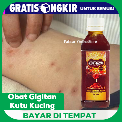 Obat Gigitan Kutu Kucing Bekas Gigitan Serangga Obat Gigitan Serangga Luka Bengkak Luka Borok Koreng Kurmaqu Lazada Indonesia