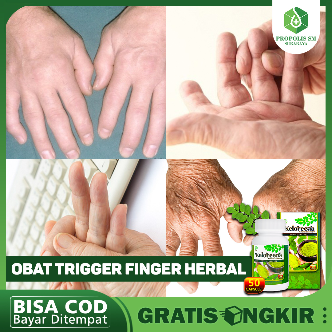 Jual Obat Herbal Trigger Finger Terbaru Lazada Co Id