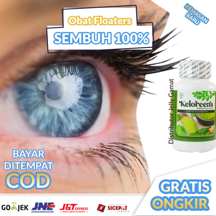 Obat Tetes Mata Minus Plus Iritasi Floaters Berlemak Glukoma Katarak Ampuh Shopee Indonesia