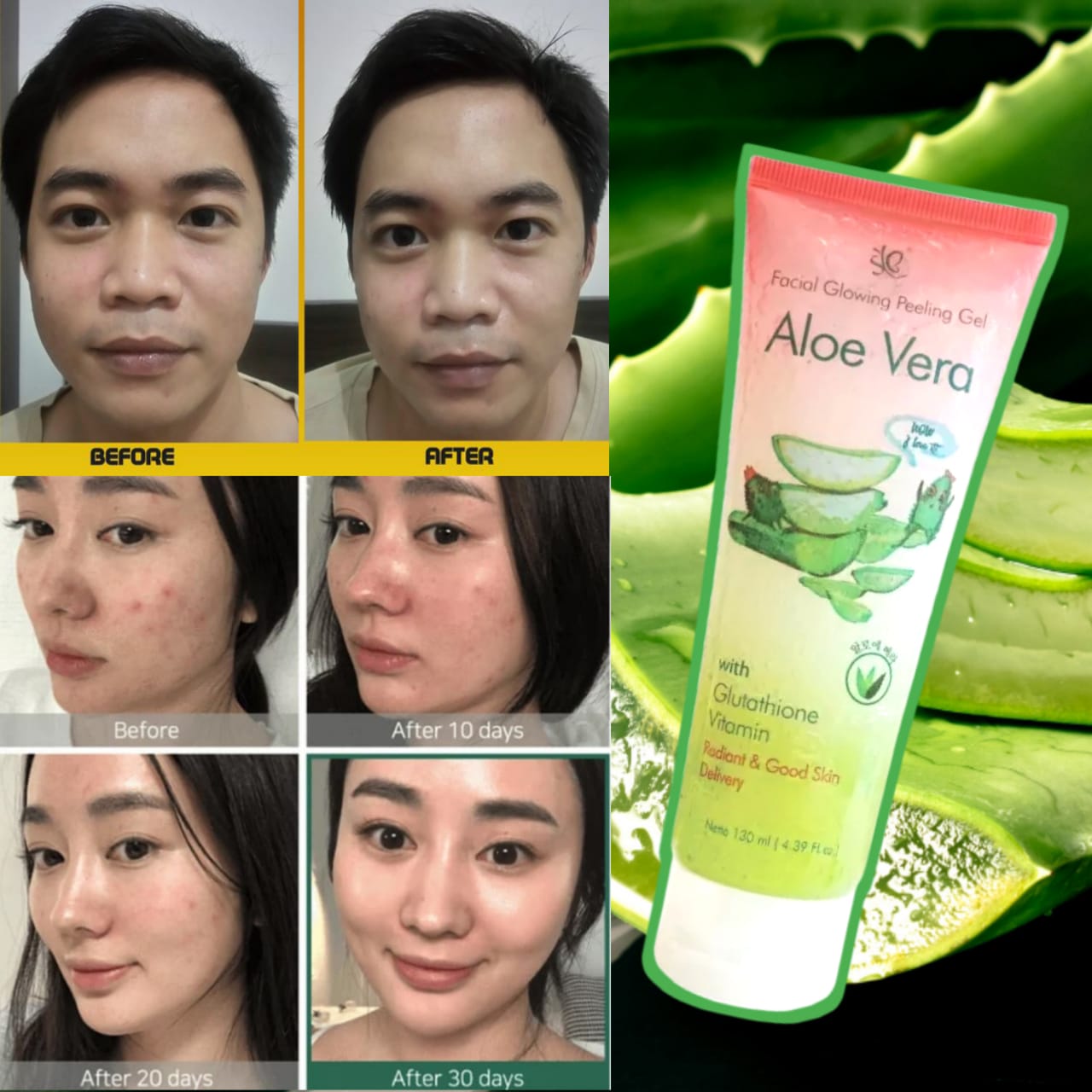 Owase Facial Glowing Peeling Gel Aloe Vera Perontok Daki Pelembab