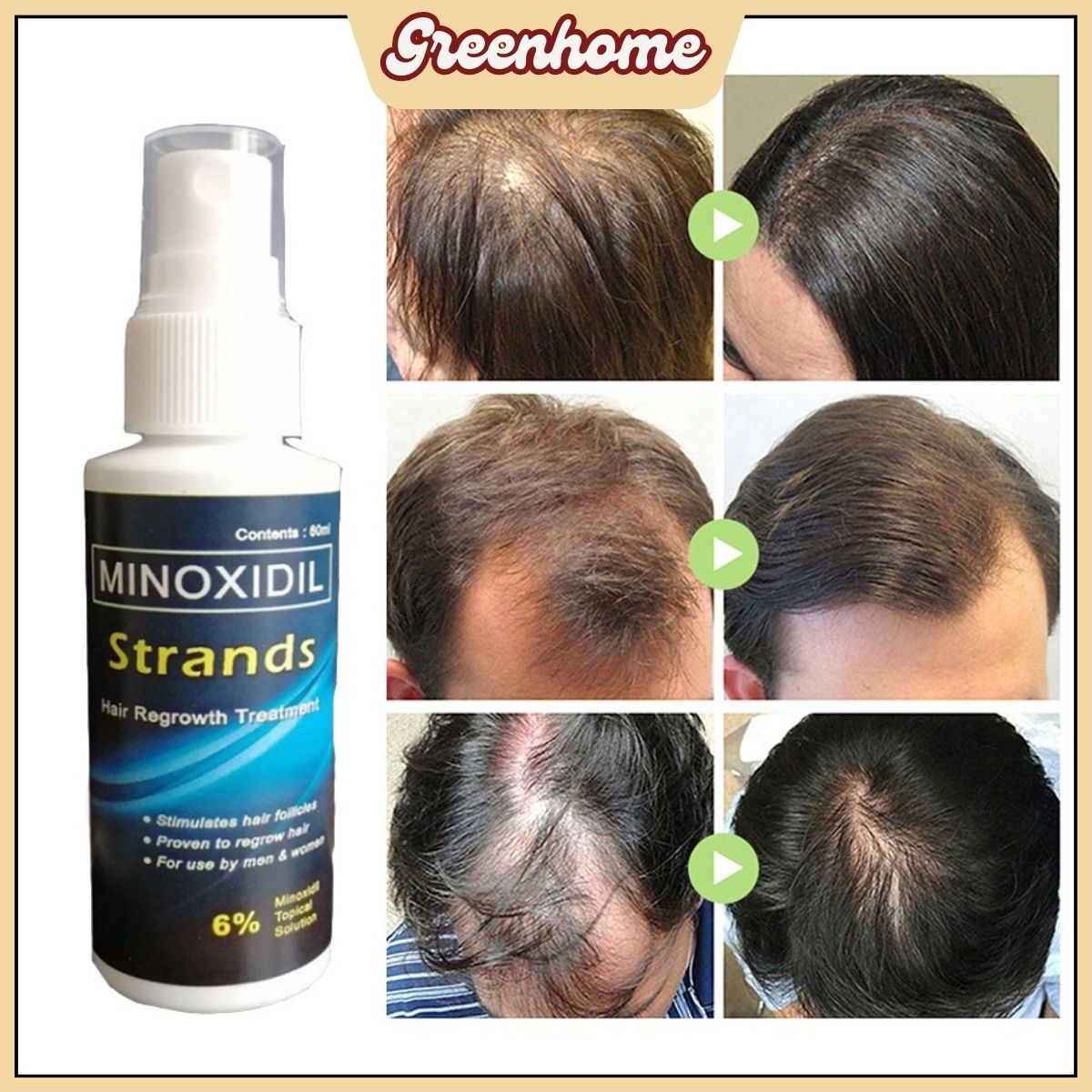 Minoxidil Strands 6% Minoxidil Kirkland Minoxidil Original Topical ...