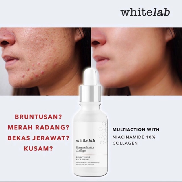 serum acne whitelab