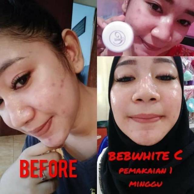 testimoni bebwhite c skincare