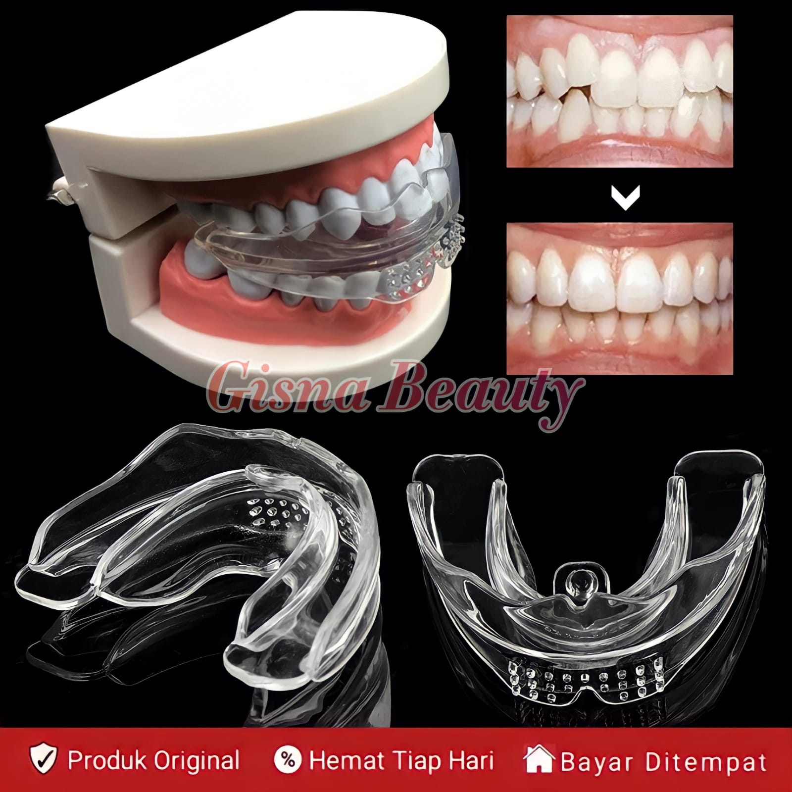 Alat perapih gigi Dijamin 100% ORIGINAL Perapi gigi tanpa behel Perata ...