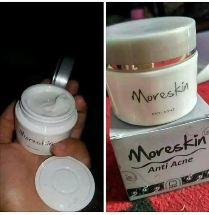 cream moreskin anti acne