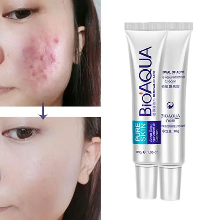 bioaqua acne rejuvenation cream bpom