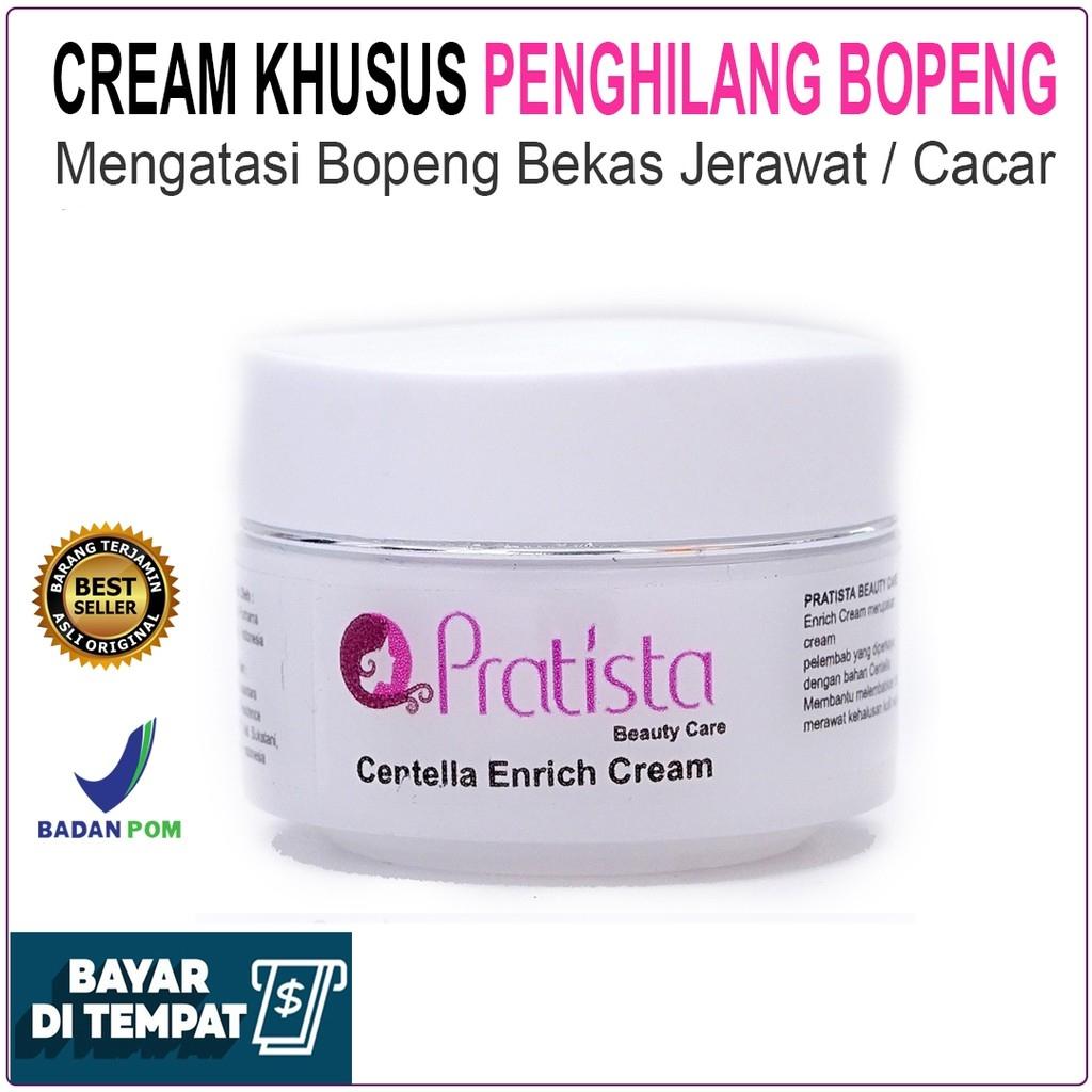 NEW Penghilang Bopeng Scar Bekas Jerawat atau Cacar / Cream Bopeng / Pratista Centella Enrich Cream