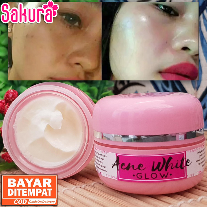 cream acne glow