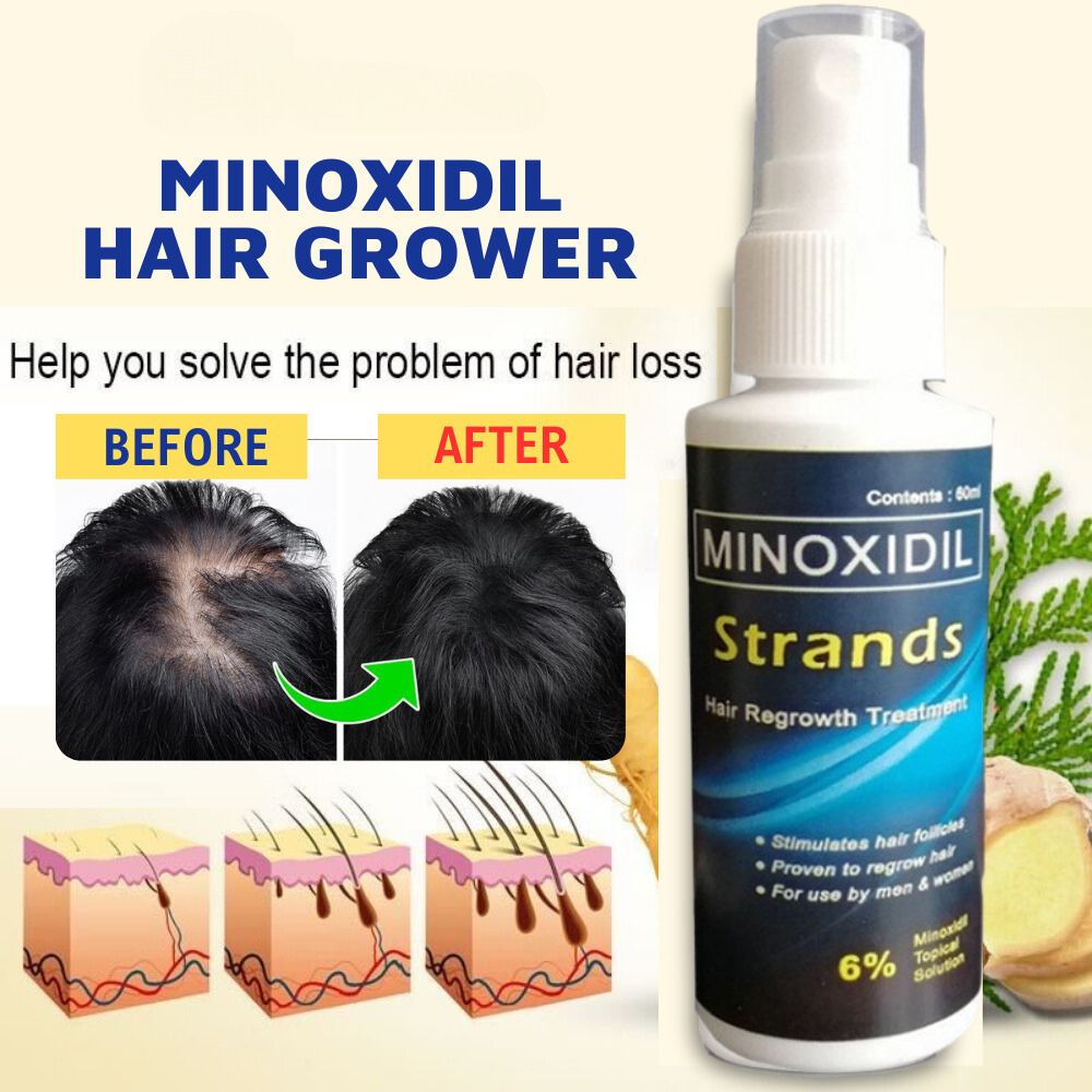 Minoxidil Strands 6 Minoxidil Kirkland Minoxidil Original Topical Solution Hair Grower Beard 1392