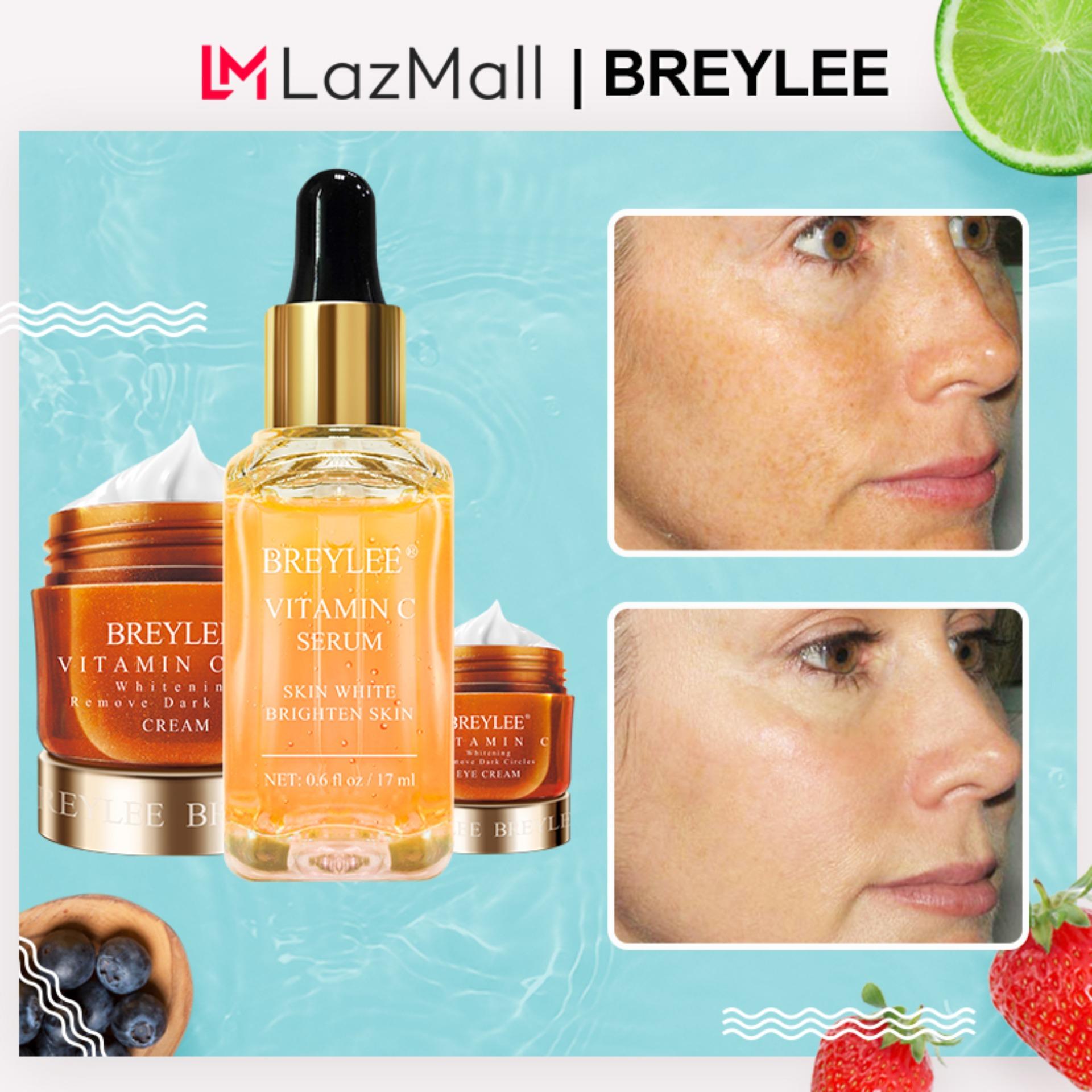 Breylee Vitamin C Whitening Set Wajah Serum Krim Mata Krim Wajah Menghilangkan Lingkaran Hitam Memudar Bintik-bintik Tempat Melanin Kulit