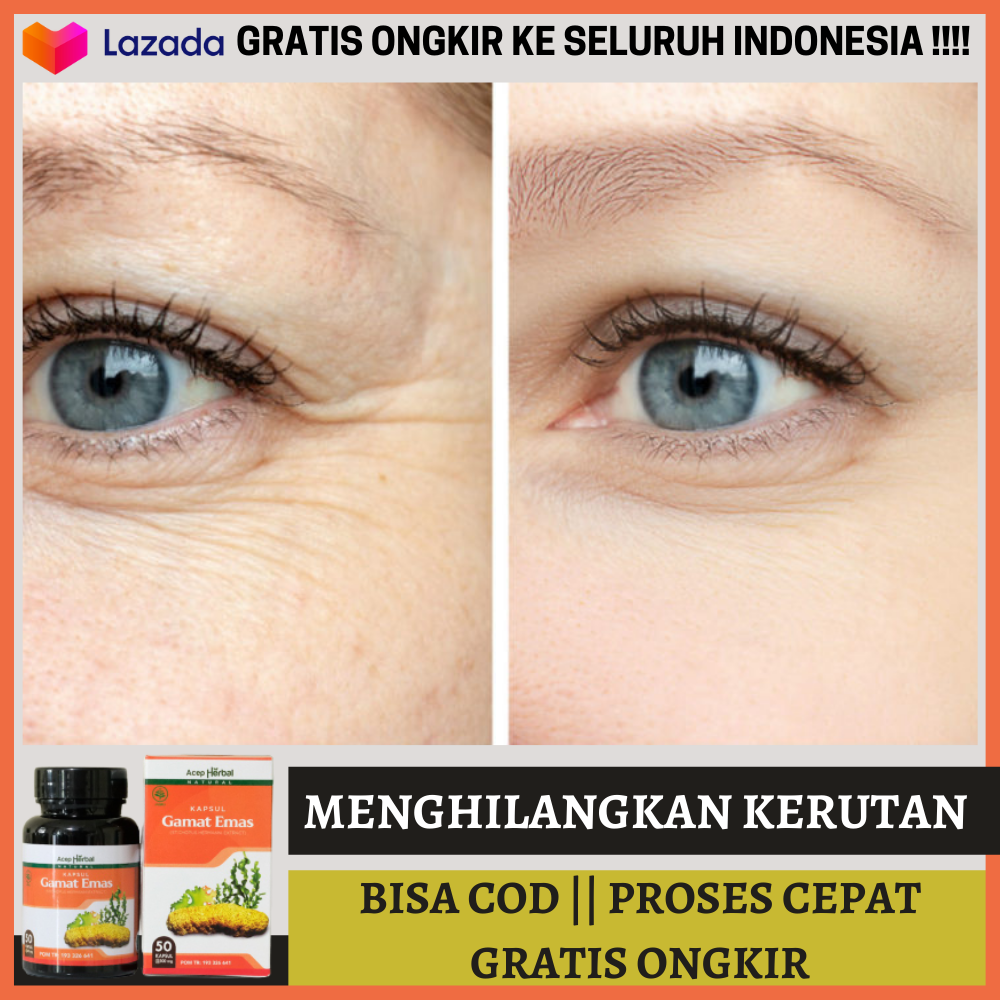 Obat Herbal Buat Ngilangin Kerutan Di Bawah Mata Agar Awet Muda Garis ...