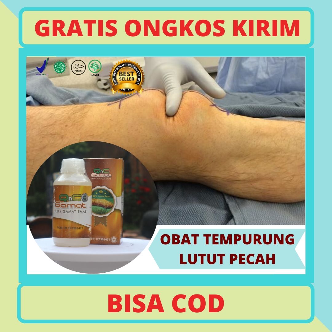 Qnc Jelly Gamat Obat Tempurung Lutut Pecah Terbaik Obat Herbal Cederea Lutut Terbagus Obat Asli Tempurung Lutut Retak Obat Tulang Dengkul Pecah Obat Tempurung Lutut Bergeser Obat Cedera Lutut Dengan