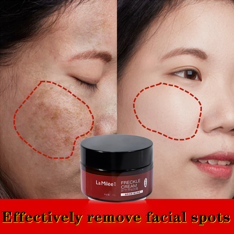 LÉMELLA WHITENING CREAM 50g(ルメラ) LÉMELLA WHITENING CREAM 50g