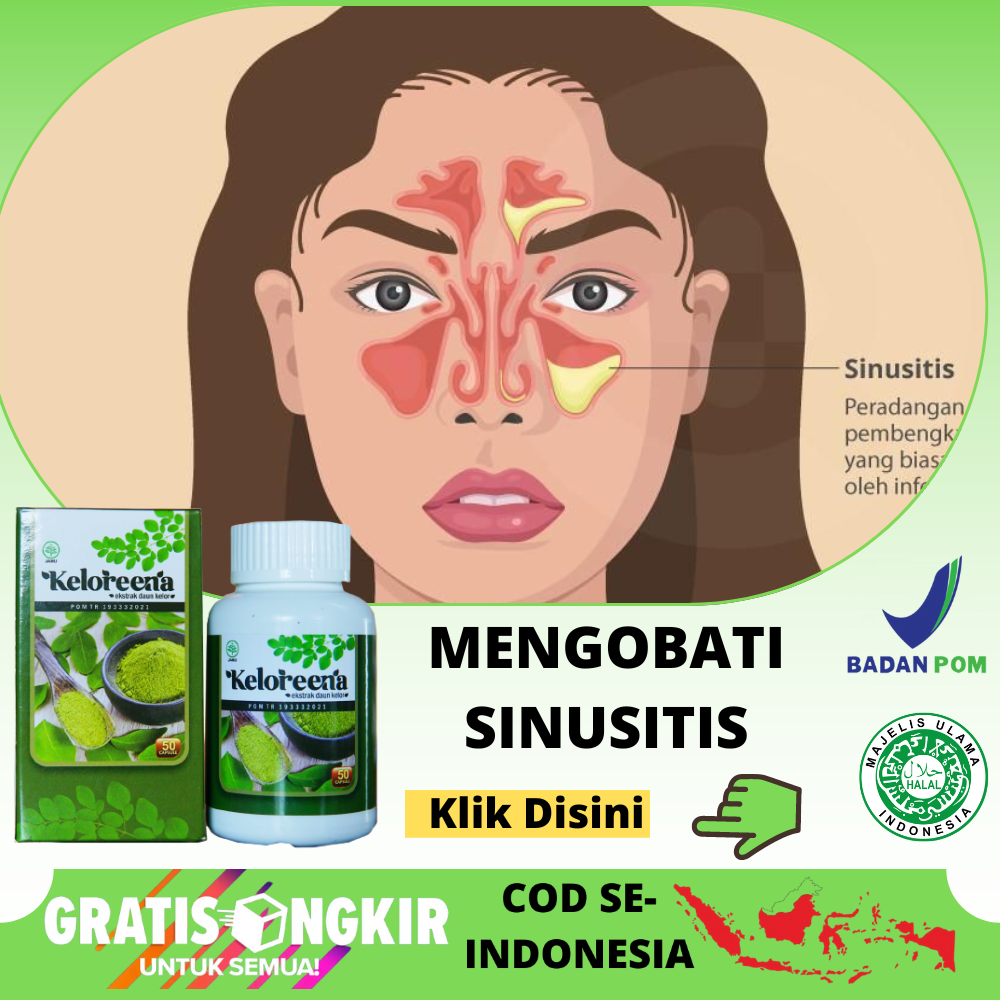 Obat Sinusitis, Herbal Buat Sinusitis Hidung Bau Busuk, Radang Sinus ...