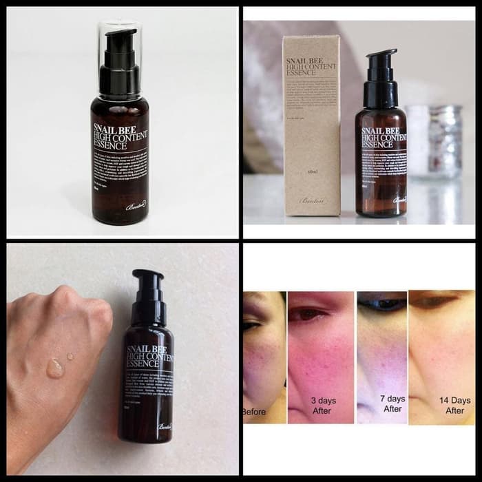 manfaat benton snail bee high content essence