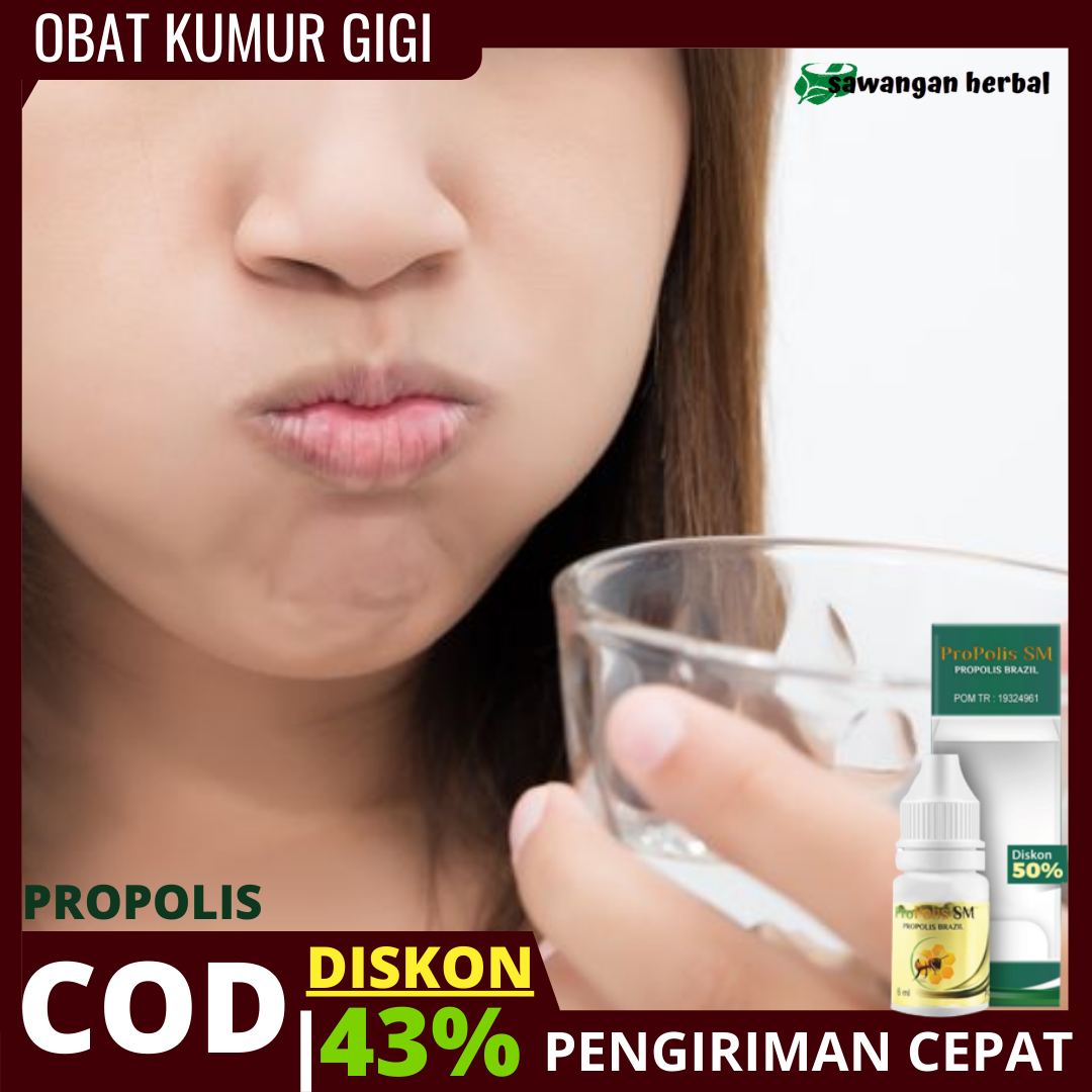 Obat kumur meredakan nyeri gigi, gigi sensitif dan berdenyut