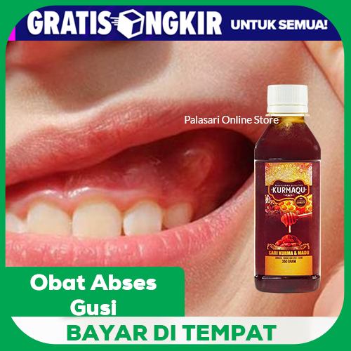 Obat Abses Gusi Dan Gigi Benjolan Di Gigi Benjolan Di Gusi Bisul Di Gusi Nyeri Gusi Gusi Bengkak Lazada Indonesia