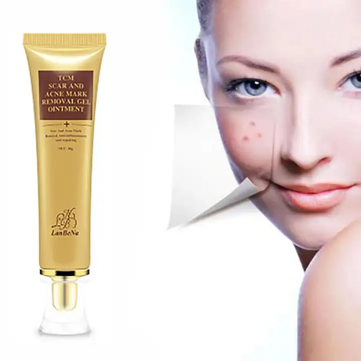 face ointment for acne