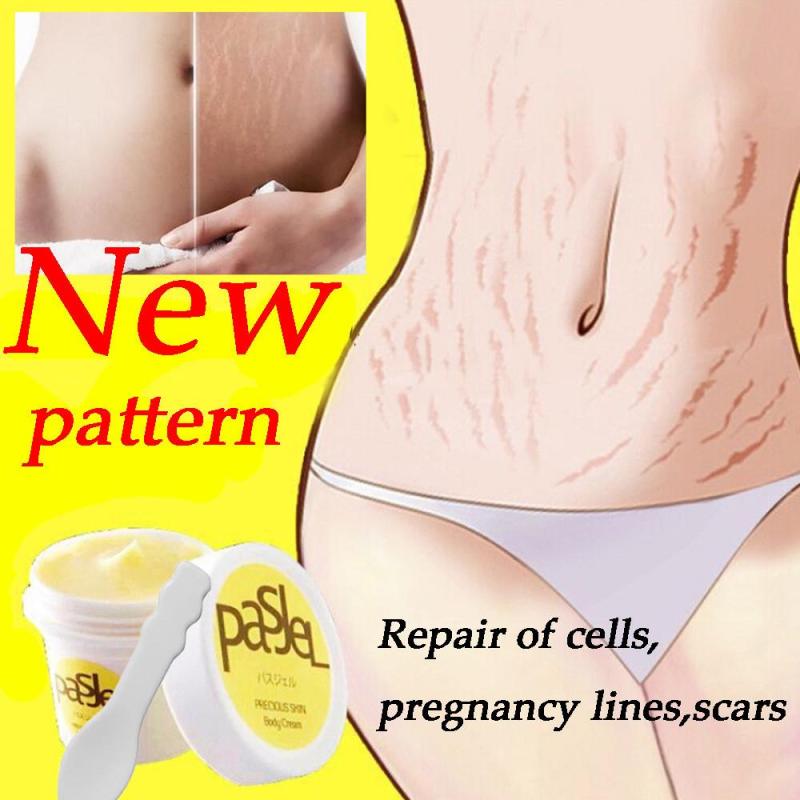 ❀New Hoa Văn Loại Bỏ Vết Rạn Da Kem Tan Mỡ Trị Sẹo Striae Gravidarum Điều Trị 50G Miễn Phí Vận Chuyển
