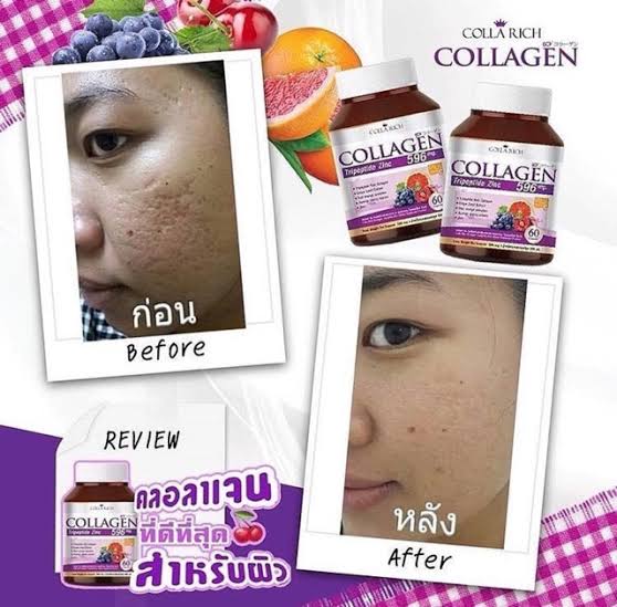 Bisa Cod Collagen Collarich 60 Kapsul Colla Rich Collarich Collagen Tripeptide Zinc Thailand Vitamin Suplemen Kecantikan Suplemen Pemutih 181 Lazada Indonesia