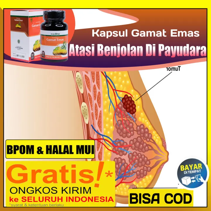 Obat Benjolan Payudara Payudara Bengkak Payudara Sakit Tumor Payudara Benjolan Abnormal Benjolan Kelenjar Getah Bening Dengan Gamat Emas Kapsul 100 Asli Original Isi 50 Kapsul Botol Lazada Indonesia