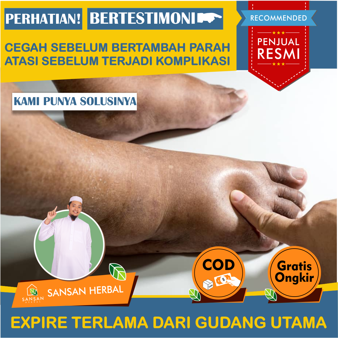 Obat Kaki Bengkak Karena Diabetes, Obat Kaki Bengkak Diabetes, Obat