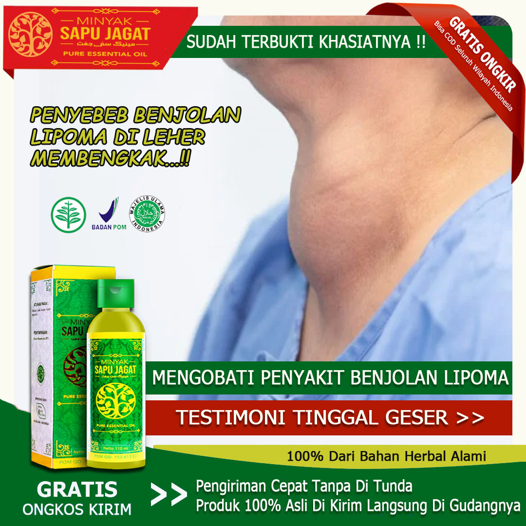 Jual Minyak Untuk Lipoma Terbaru Lazada Co Id