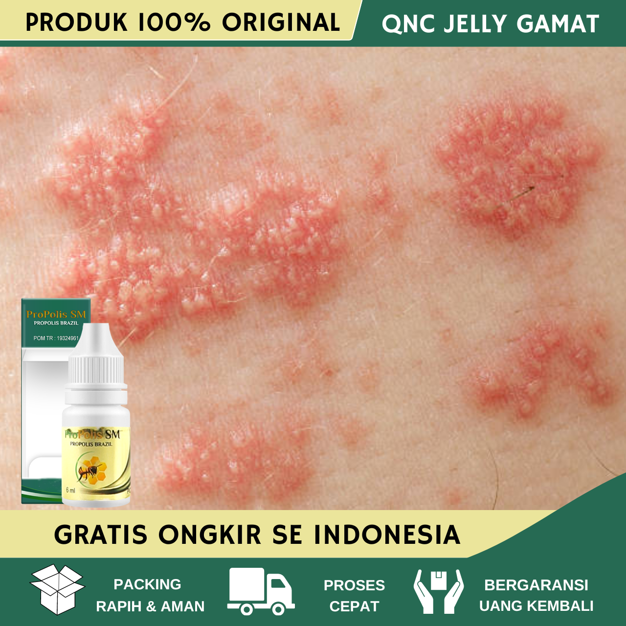 Obat Herpes Kelamin Pria Obat Herpes Kelamin Wanita Obat Herpes Pada