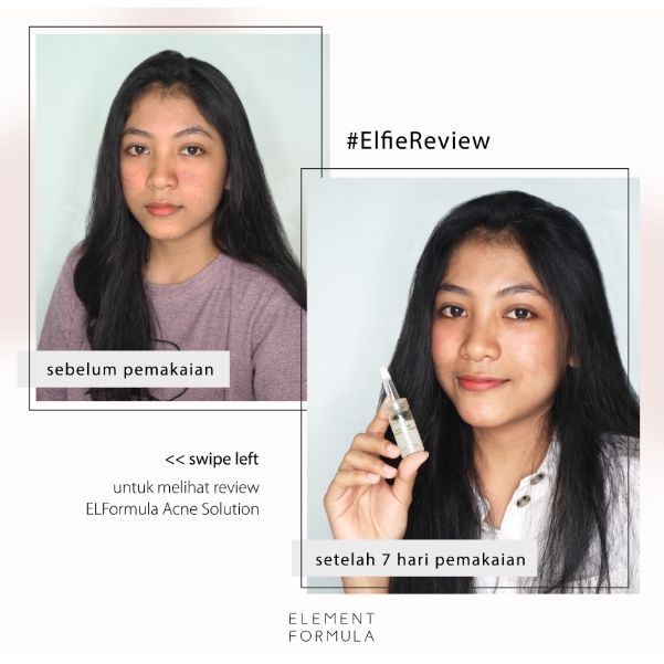 serum elformula acne