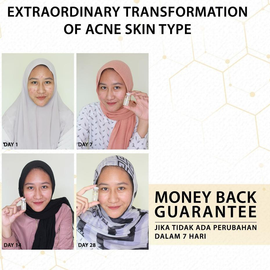 elformula 28 days acne relief repairing solution