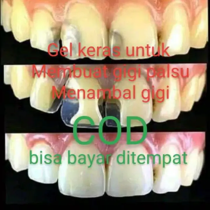 Gigi Palsu Temptooth Temporary Tooth Lem Tambal Gigi Patah Berlubang Bolong Renggang Ompong Bisa Buat Sendiri Lazada Indonesia Gigi Palsu Temptooth Temporary Tooth Lem Tambal Gigi Patah Berlubang Bolong Renggang Ompong Bisa Buat Sendiri Lazada Indonesia