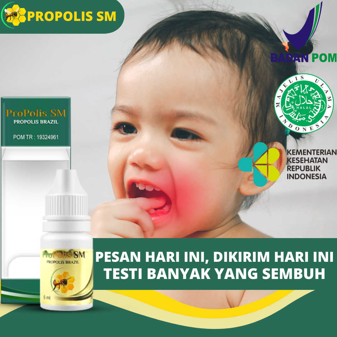 Obat Sakit Gigi Berlubang, Obat Tetes Sakit Gigi, Obat Sakit Gigi Anak ...