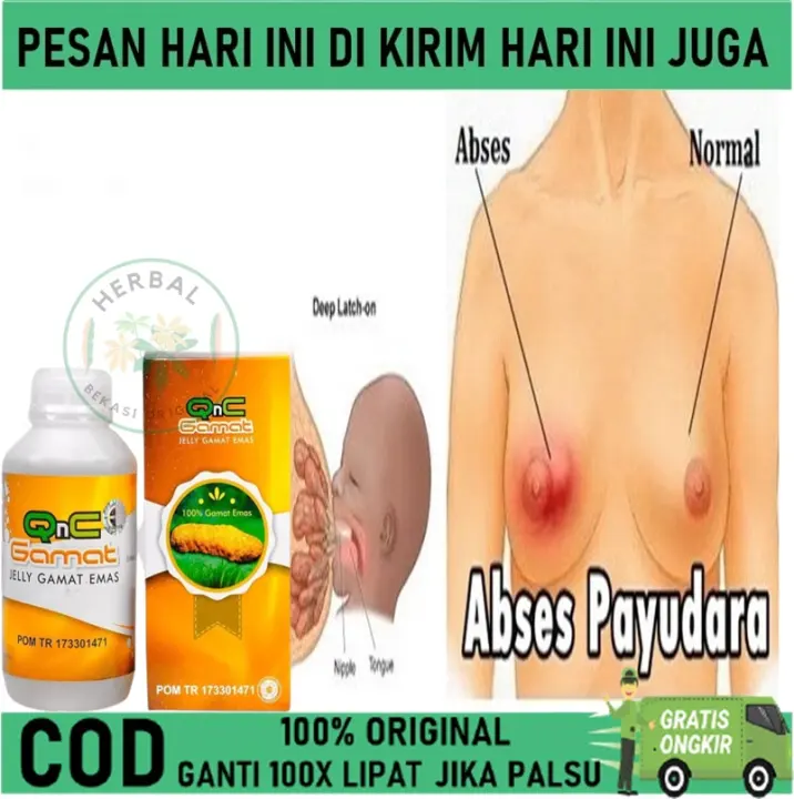 Cod Obat Benjolan Payudara Obat Abses Payudara Obat Payudara Bengkak Obat Nyeri Payudara Obat Bisul Di Payudara Obat Kanker Payudara Obat Tumor Payudara Lazada Indonesia