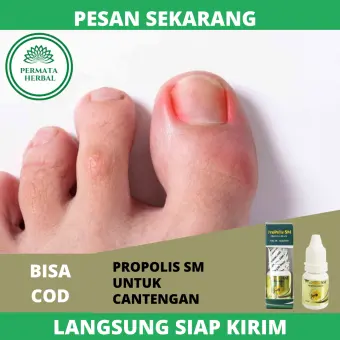 Obat Cantengan Herbal Obat Cair Cantengan Obat Cantengan Di Kuku Kaki Obat Cantengan Di Jempol Kaki