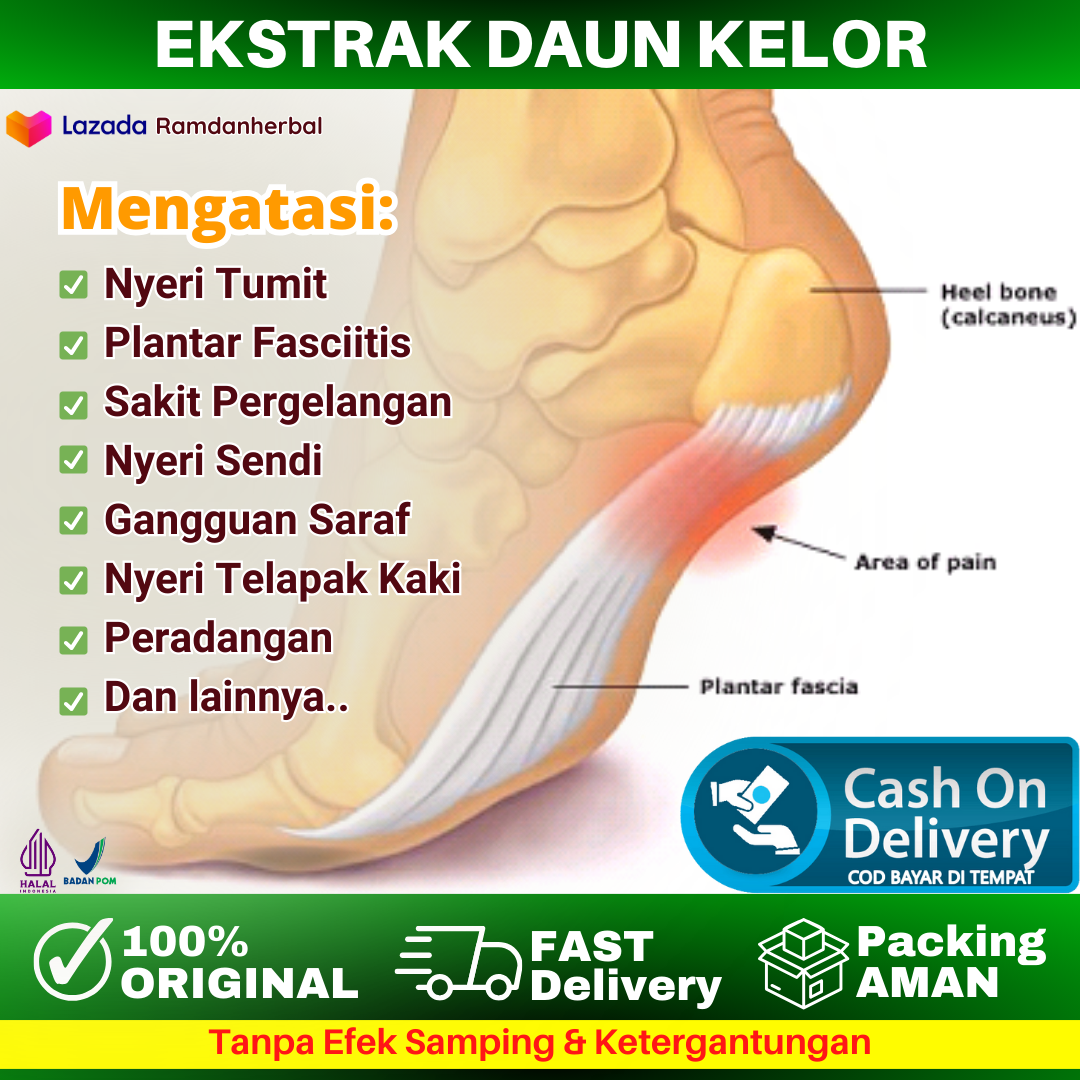 Obat plantar sale fasciitis