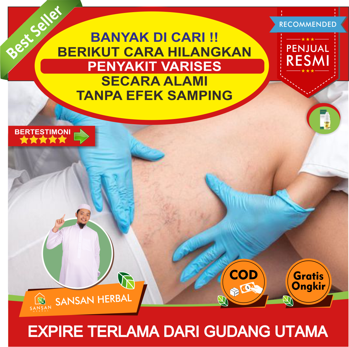 Obat Herbal Varises Kaki, Obat Yang Dapat Menghilangkan Varises, Obat