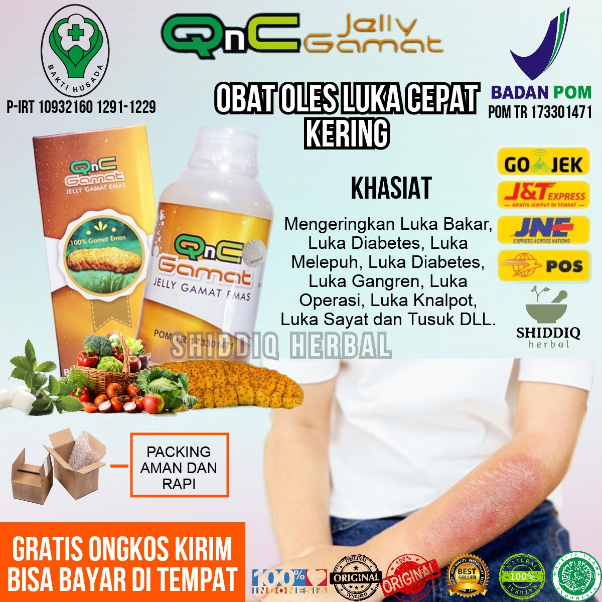 OBAT HERBAL ALAMI Luka Bakar, Penghilang Bekas Luka Bakar, Keloid