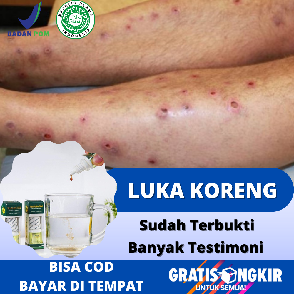 Obat Luka Koreng Bernanah, Herbal Mengeringkan Koreng Basah Berair