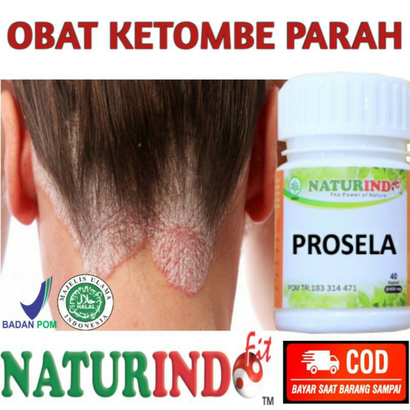 Jual Obat Ketombe Ampuh Terbaru Lazada Co Id