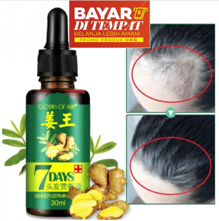 Cod Serum Pertumbuhan Rambut Penumbuh Rambut Botak Penumbuh Rambut Pitak Penumbuh Rambut Botak Katumbiri Lazada Indonesia