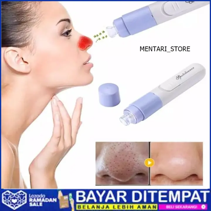 pore cleanser terbaik