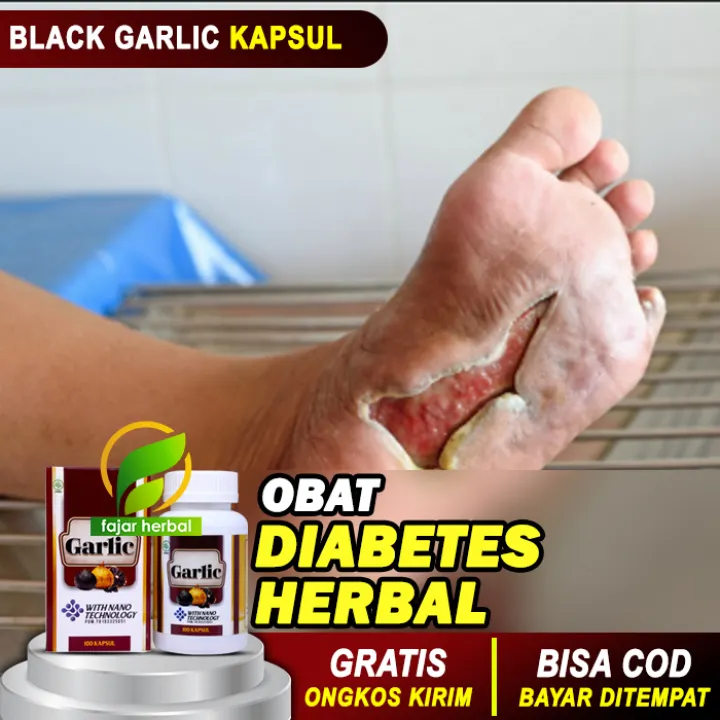 100 Kapsul Obat Diabetes Gula Basah Obat Pengering Luka Diabetes Obat Herbal Premium Bawang Hitam Kapsul Bukan Obat Cina China Terdaftar Di Bpom Dijamin Original Lazada Indonesia