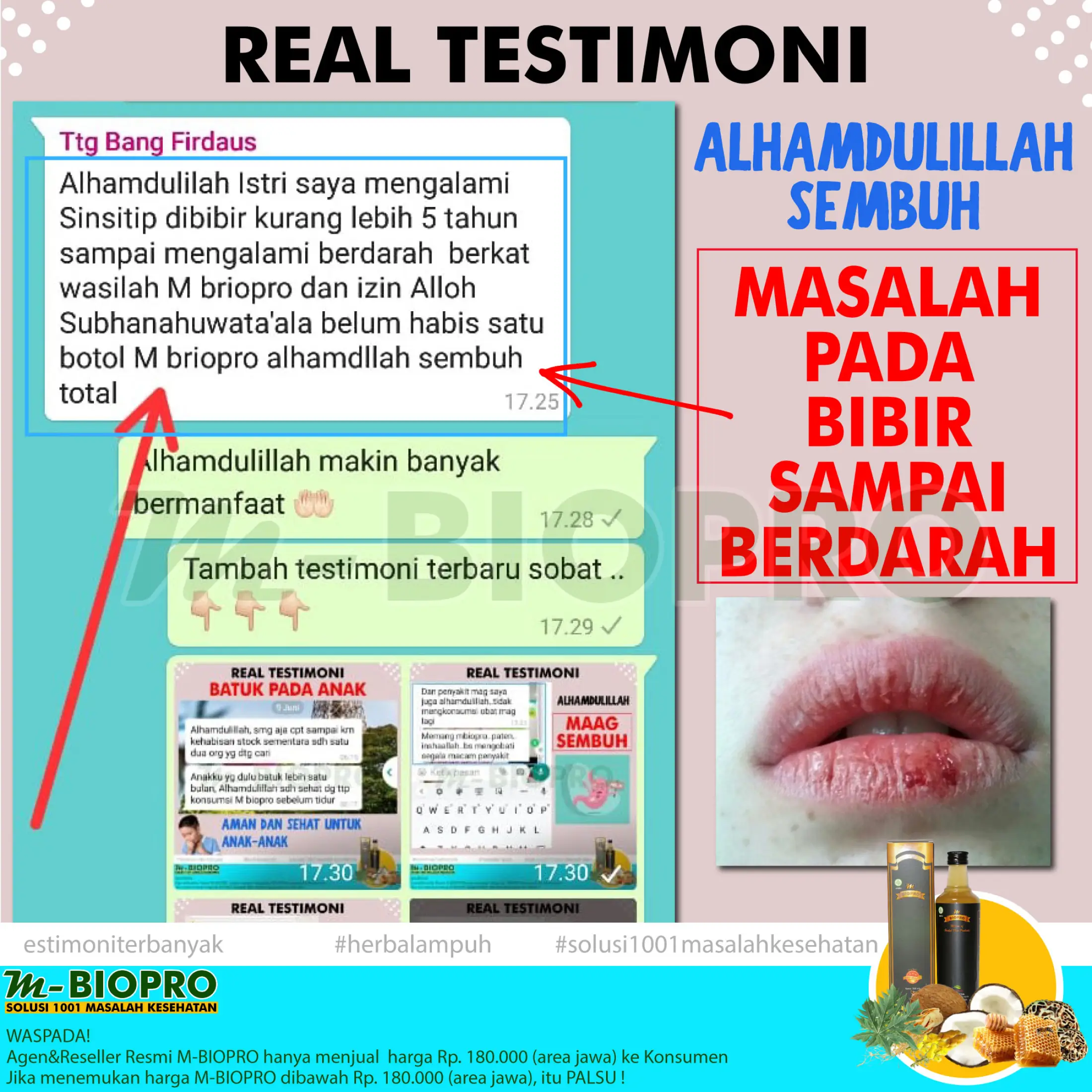 Obat Bibir Kering Pecah Pecah Bibir Hitam Dan Kering Mengatasi Bibir Kering Dan Gatal Obat Bibir Kering Pecah Pecah Sariawan Mbiopro 100 Original Herbal Alami Mengatasi Bibir Pecah