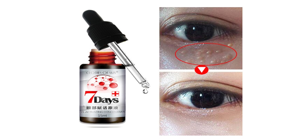 eye cream untuk milia