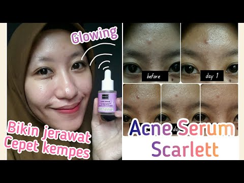 testi serum scarlett acne