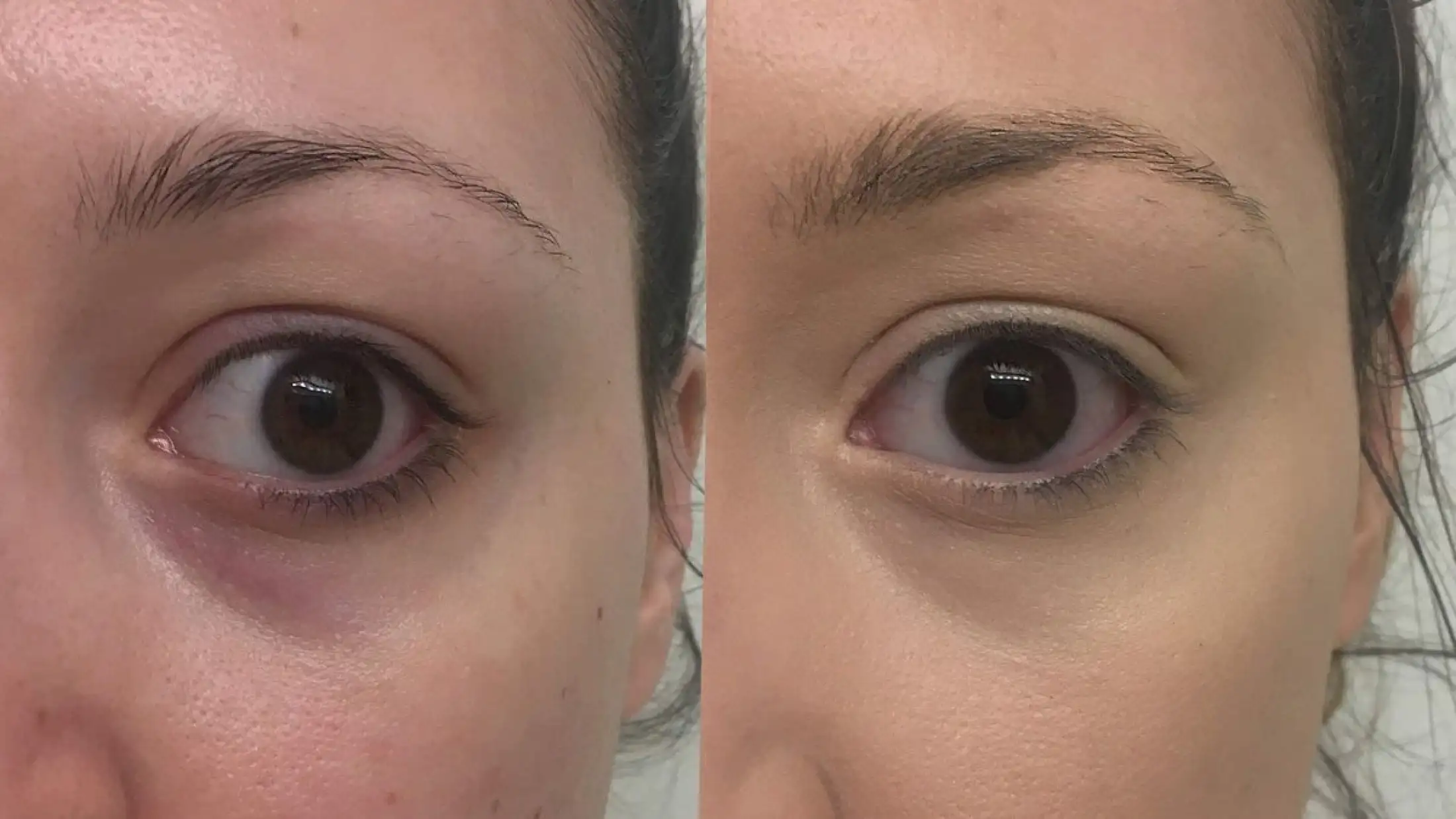 ms glow dark circle eye cream