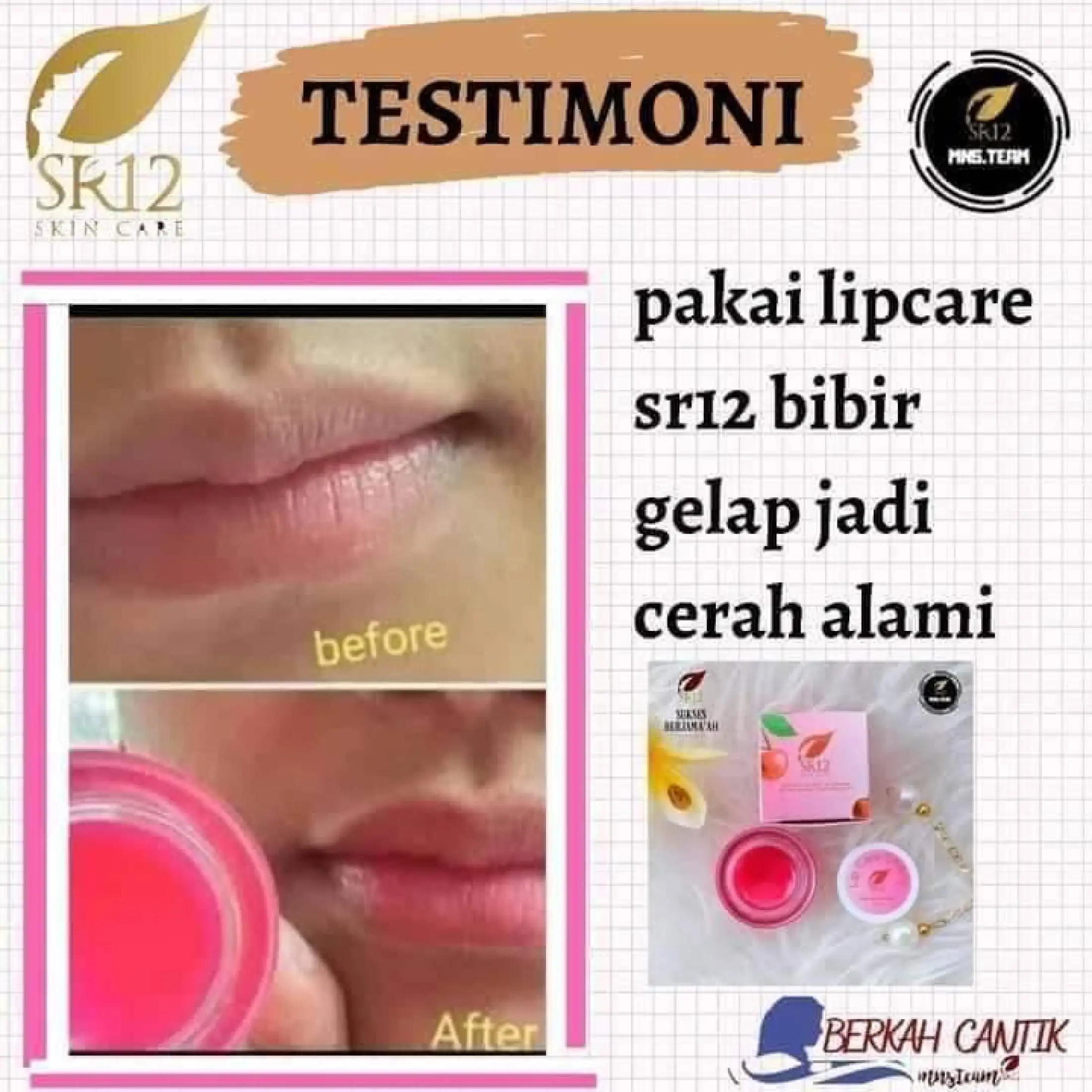 Lip Care Sr12 Lipbalm Pelembab Bibir Pencerah Warna Bibir Hempas Bibir Kering Pecah Pecah Lazada Indonesia