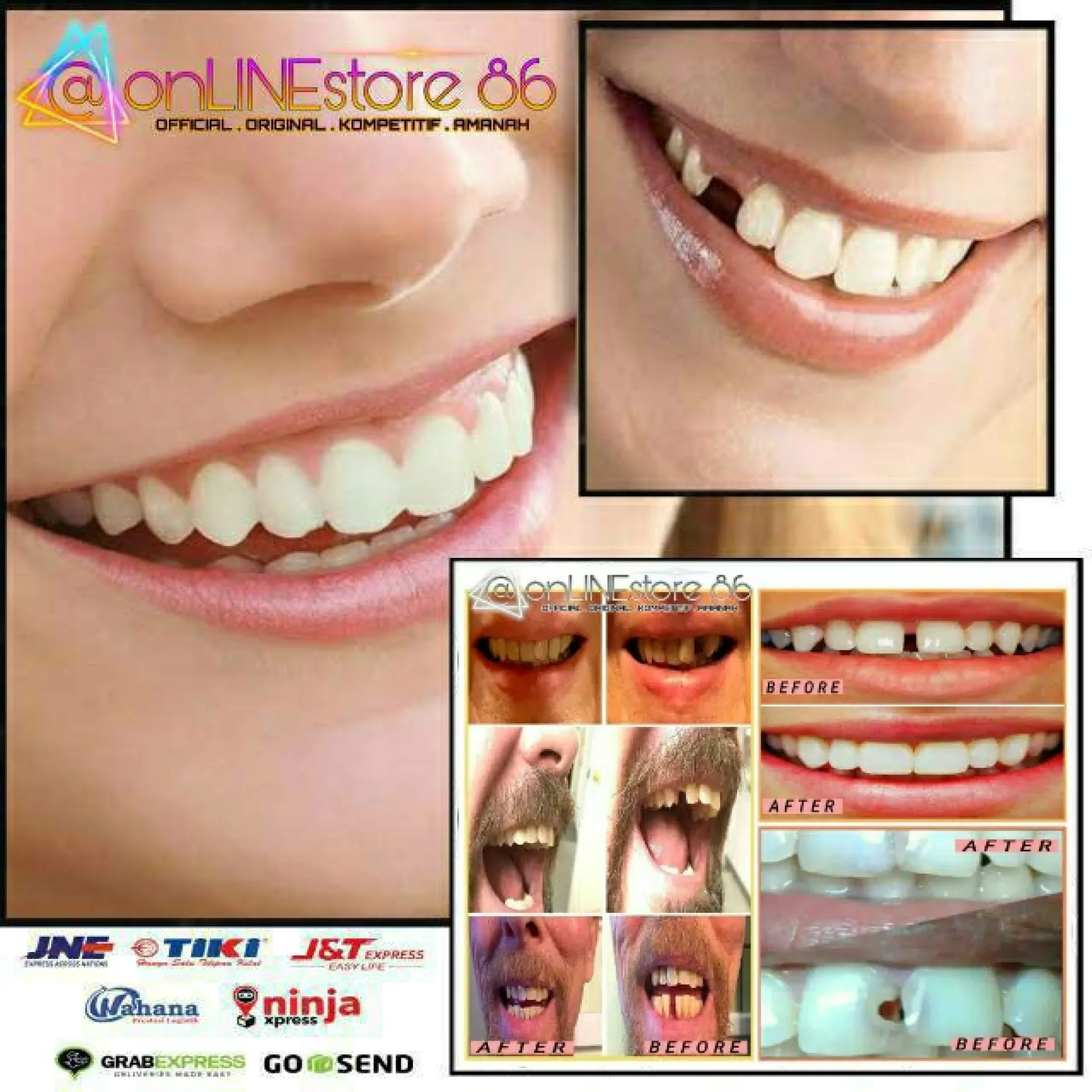 Promo Gigi Palsu Temptooth Temporary Tooth Lem Tambal Gigi Instan Kuat A Untuk Memperbaiki Gigi Patah Berlubang Gigi Bolong Gigi Ompong Dan Gigi Renggang Sangat Termurah Sekali Bisa Cod Lazada Indonesia
