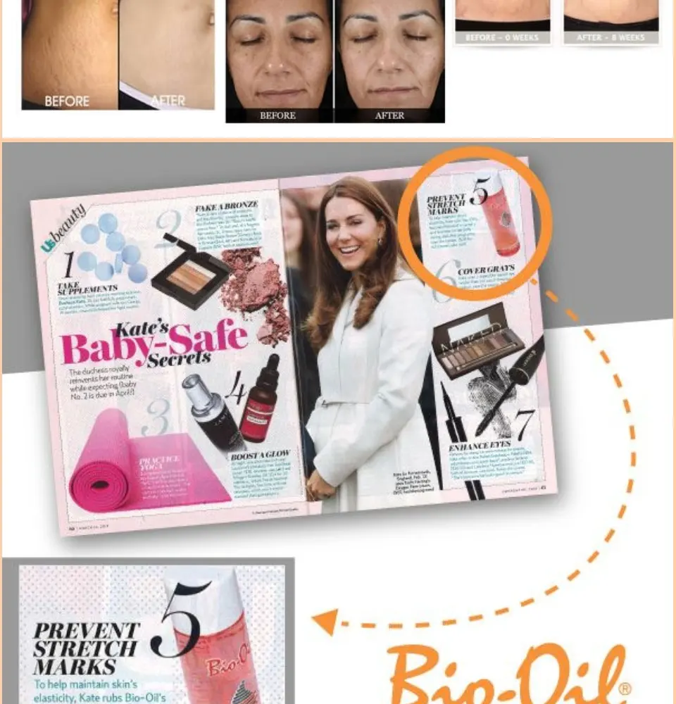 Bio Oil 25ml Penghilang Bekas Luka Anti Scar Stretchmark Dan Selulit Penghilang Bekas Luka Hilangkan Bekas Jerawat Penghilang Flek Hitam Bio Oil Minyak Perawatan Kulit Bekas Luka Dan